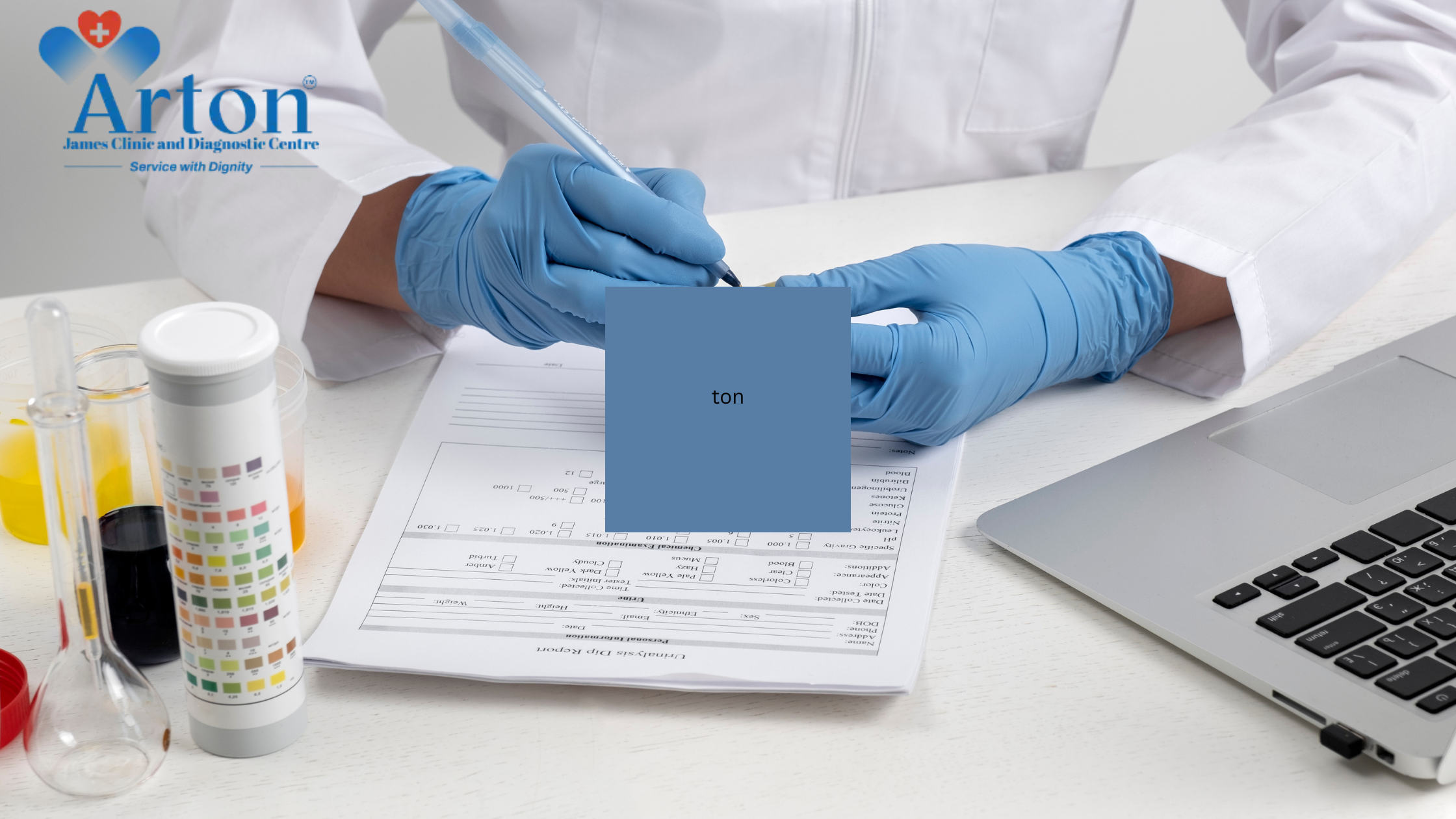 Lipid Profile Test in Kolkata