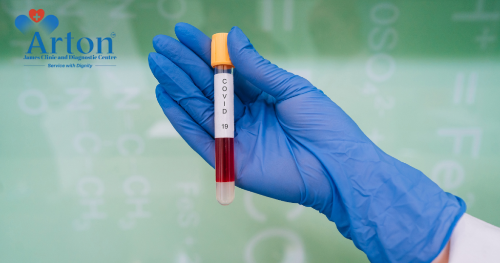 Lipid Profile Test in Kolkata